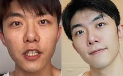 什么的脸(细腻白嫩的肌肤如何打造令人羡慕的美容面容)