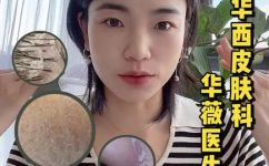 皮肤脱皮的原因有什么呢(了解皮肤脱皮的原因有哪些)