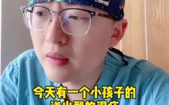 得了湿疹怎么治疗好得快(如何迅速有效地治疗湿疹？5种快速缓解湿疹方法分享)