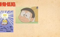 颧骨怎么读什么意思(颧骨读音及解析，详细了解颧骨的意义)