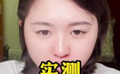痛风可以吃汤圆吗(痛风患者可以享用汤圆吗？)